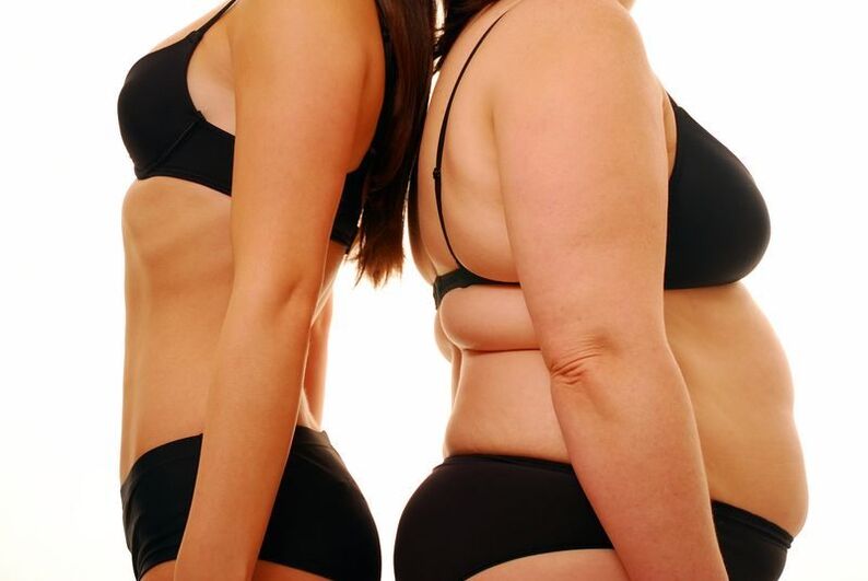 corpo magro e obesità come causa delle vene varicose